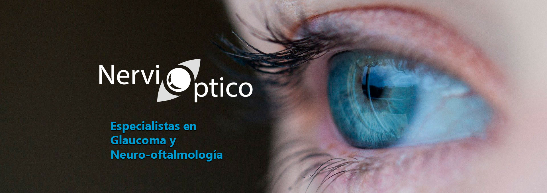 Nervio optico Cali